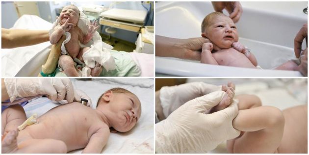 beba-Apgar-novorodzence-porod