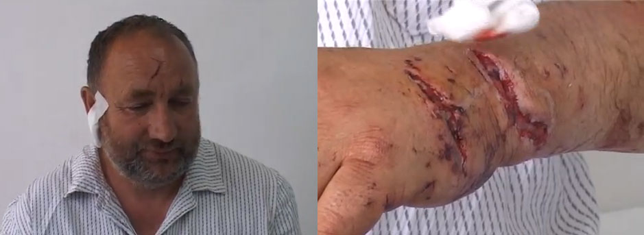 Gorštak iz Gacka medvjedu skoro otkinuo glavu "On je mene ujedo, a ja njeg udaro" (VIDEO)