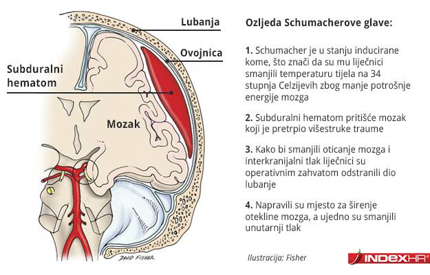 Schumacher ''i dalje kritično'', policija dobila kameru s kacige