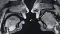 Pogledajte kako izgleda seks 'iznutra', snimljen magnetnom rezonancom (VIDEO)
