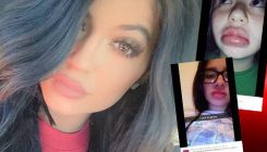 Bizarni izazov koji je zavladao Twitterom: Usne u stilu Kylie Jenner