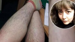Ne srami se prirodnog izgleda: 19-godišnja studentica ne želi da se depilira (FOTO)
