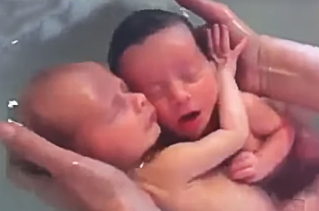 Zavirite u svijet (ne)rođenih blizanaca - ovo je ljubav koja nema premca (VIDEO)
