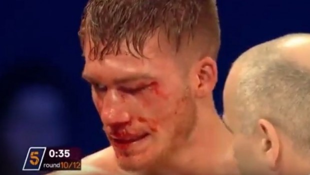 Bokser Nick Blackwell završio u komi poslije borbe za titulu (VIDEO)