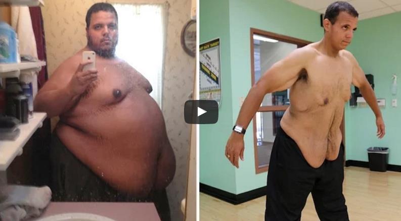 Provodio vrijeme na internetu, ugojio se 350 kg, a onda su počele temeljne promjene (VIDEO)