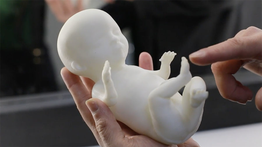 3D print bebe iz utrobe kako bi ih mame mogle vidjeti i prije rođenja (VIDEO)