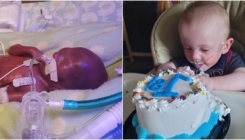 Ušao u Guinnessovu knjigu rekorda kao najranije rođena beba ikada, a sada je proslavio prvi rođendan...