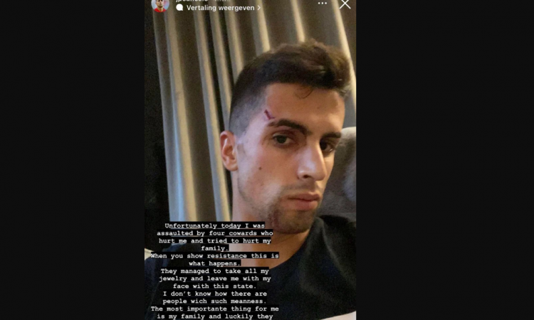 Bek Manchester Cityja Joao Cancelo pretučen u napadu pljačkaša u njegovom domu