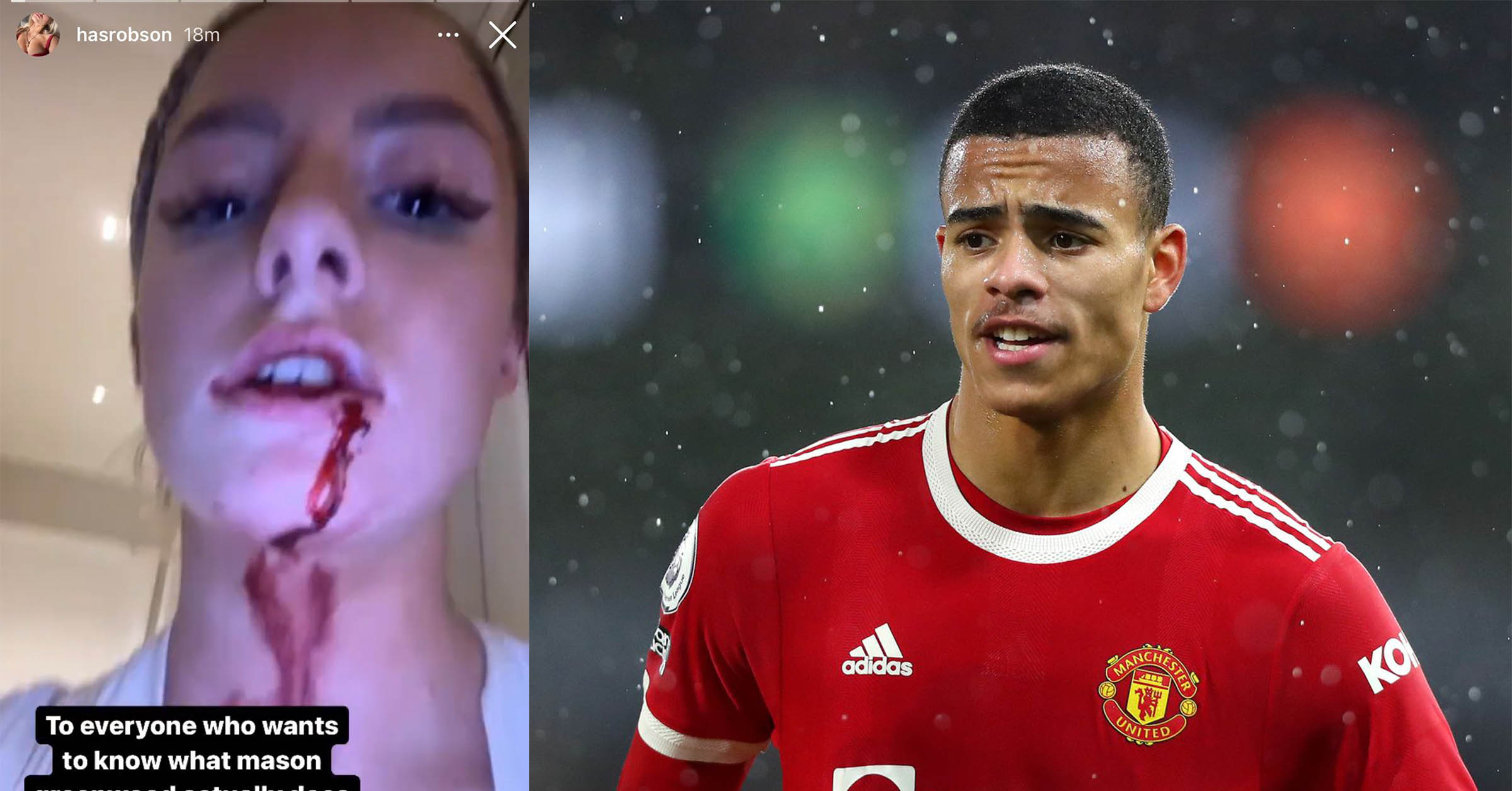 Napadač Manchester Uniteda Greenwood pušten uz kauciju