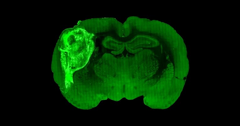 Naučnici mišu ugradili minijaturni ljudski mozak: Evo šta su otkrili