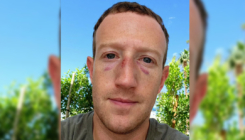 Mark Zuckerberg osvanuo s masnicama ispod očiju. Objasnio šta mu se dogodilo