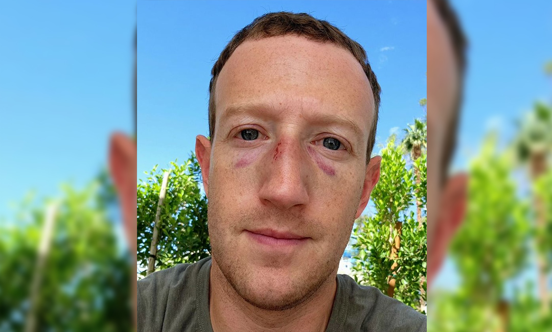 Mark Zuckerberg osvanuo s masnicama ispod očiju. Objasnio šta mu se dogodilo