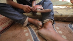 Palestinski medicinski tehničar: Kako bi prehranila djecu, majka u Gazi prodaje bubreg