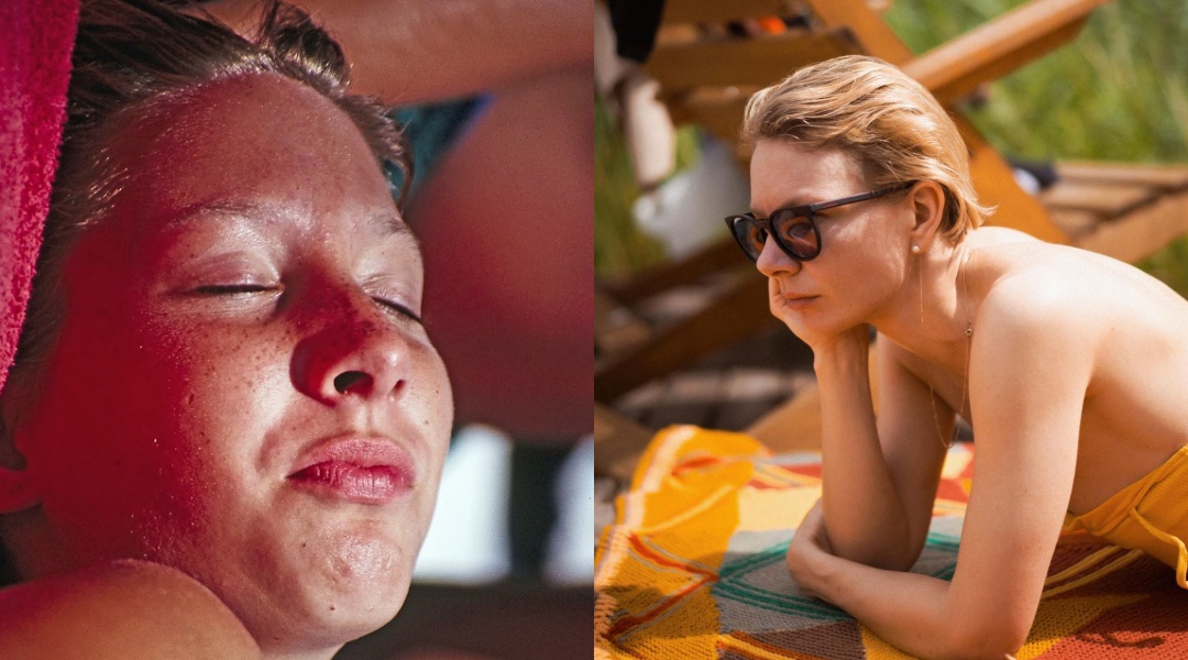 Šta kada vaša koža izgori na suncu? Isprobajte neki od ovih devet efikasnih kućnih rješenja